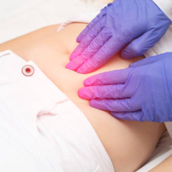 Fibroid Treatment Without Surgery: Modern Ways to Reclaim Women's Health Naturally