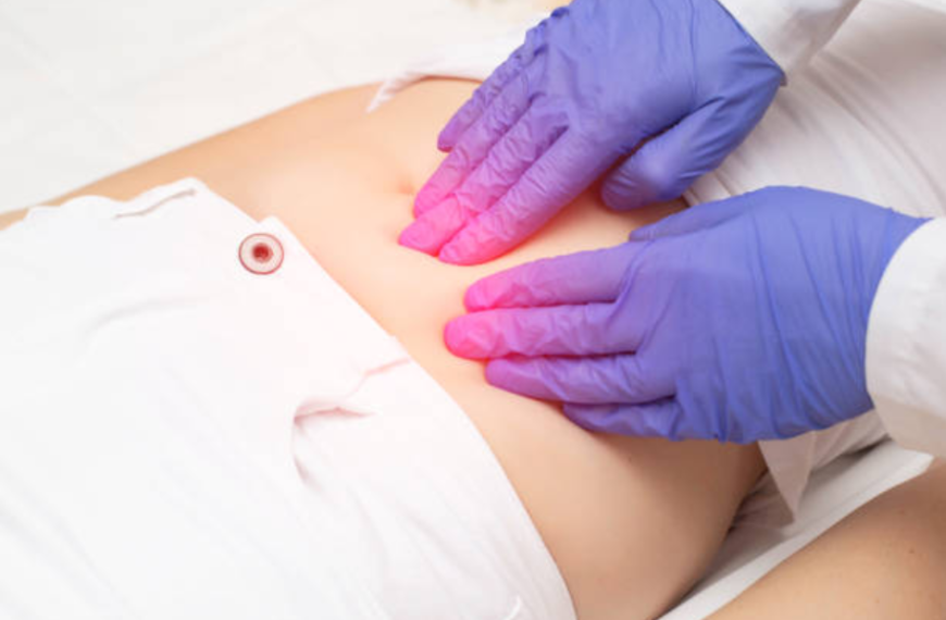 Fibroid Treatment Without Surgery: Modern Ways to Reclaim Women's Health Naturally